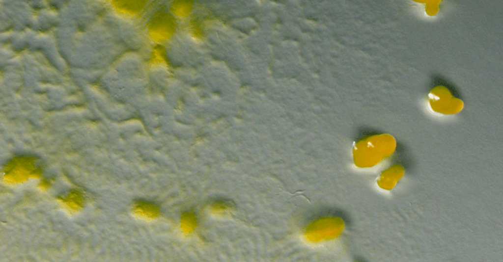 A Sulfate-reducing Bacteria