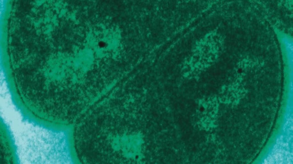 Deinococcus Radiodurans