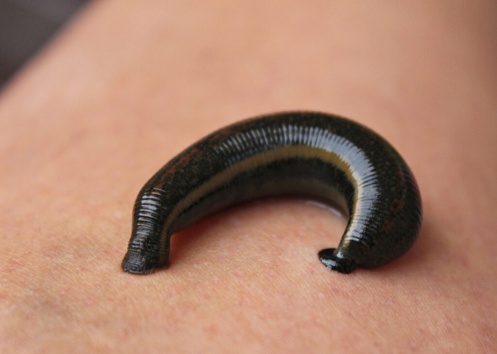 Leeches
